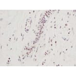 Immunohistochemistry - Anti-CTGF Antibody - BSA and Azide free (A283086) - Antibodies.com