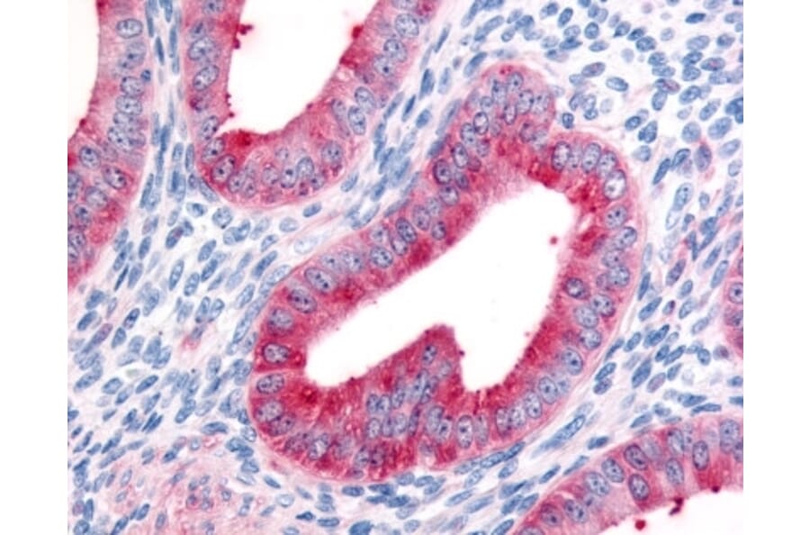 Immunohistochemistry - Anti-Fibroblast Activation Protein, alpha Antibody (A283098) - Antibodies.com