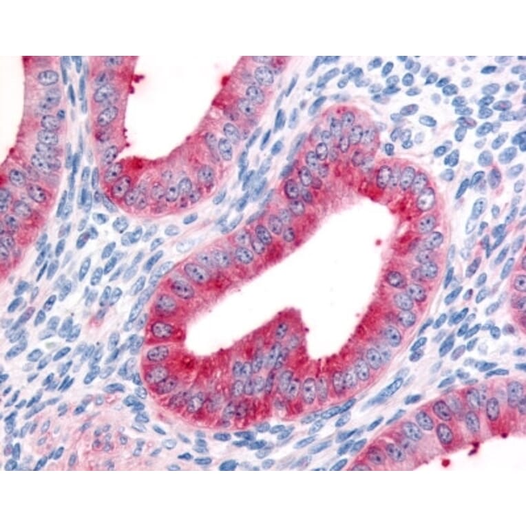 Immunohistochemistry - Anti-Fibroblast Activation Protein, alpha Antibody (A283098) - Antibodies.com