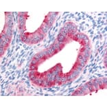 Immunohistochemistry - Anti-Fibroblast Activation Protein, alpha Antibody (A283098) - Antibodies.com