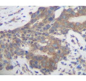 Immunohistochemistry - Anti-PLGF Antibody - BSA and Azide free (A283112) - Antibodies.com