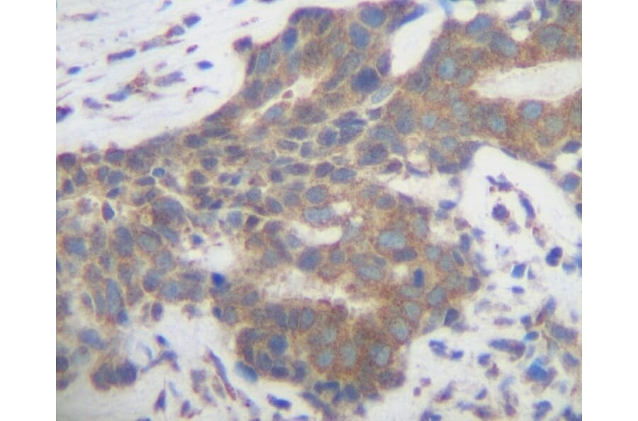 Immunohistochemistry - Anti-PLGF Antibody - BSA and Azide free (A283112) - Antibodies.com