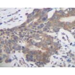 Immunohistochemistry - Anti-PLGF Antibody - BSA and Azide free (A283112) - Antibodies.com