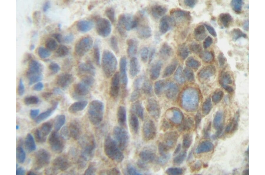 Immunohistochemistry - Anti-PLGF Antibody - BSA and Azide free (A283112) - Antibodies.com