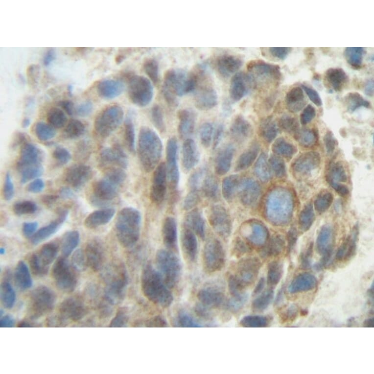 Immunohistochemistry - Anti-PLGF Antibody - BSA and Azide free (A283112) - Antibodies.com