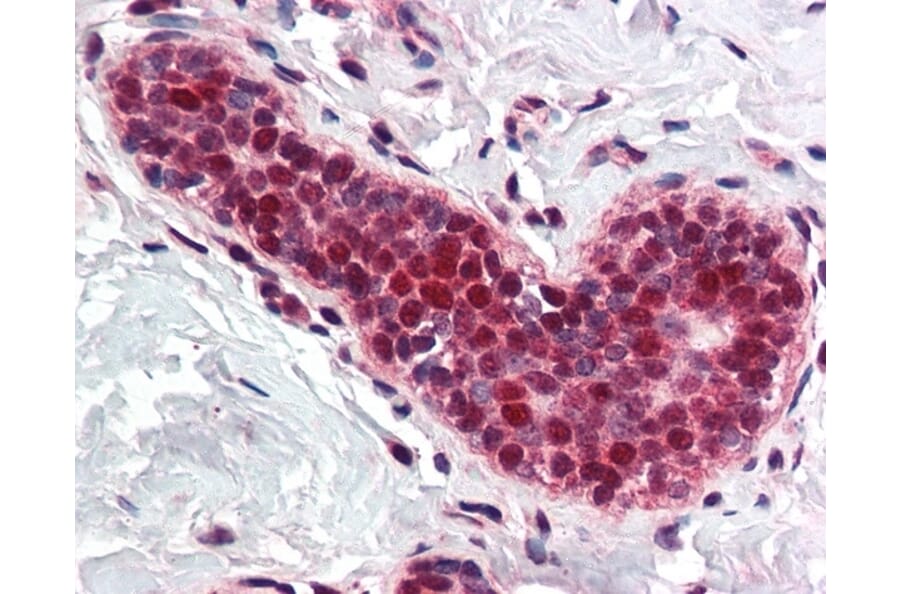 Immunohistochemistry - Anti-PCNA Antibody (A283116) - Antibodies.com