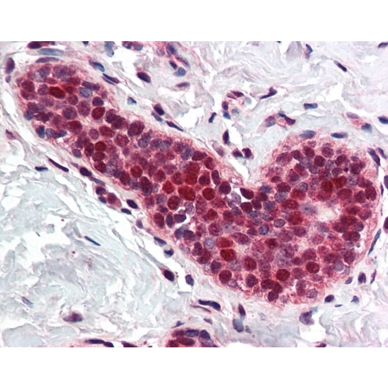 Immunohistochemistry - Anti-PCNA Antibody (A283116) - Antibodies.com