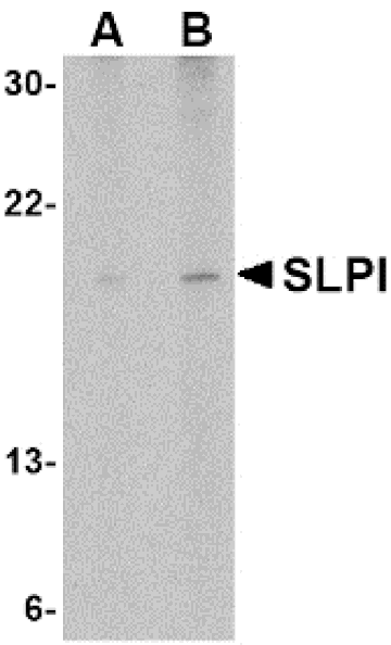 Western Blot - Anti-SLPI Antibody (A283123) - Antibodies.com
