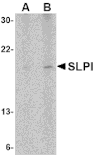 Western Blot - Anti-SLPI Antibody (A283123) - Antibodies.com