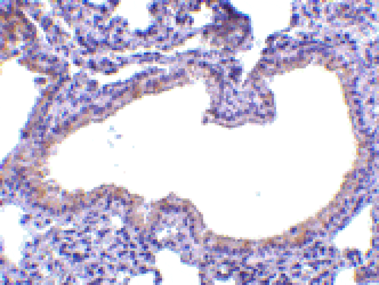 Immunohistochemistry - Anti-SLPI Antibody (A283123) - Antibodies.com