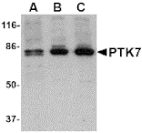 Western Blot - Anti-CCK4 Antibody (A283125) - Antibodies.com