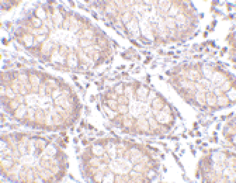 Immunohistochemistry - Anti-CCK4 Antibody (A283125) - Antibodies.com