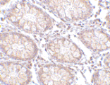 Immunohistochemistry - Anti-CCK4 Antibody (A283125) - Antibodies.com