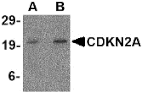 Western Blot - Anti-CDKN2A Antibody (A283136) - Antibodies.com