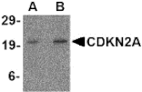 Western Blot - Anti-CDKN2A Antibody (A283136) - Antibodies.com