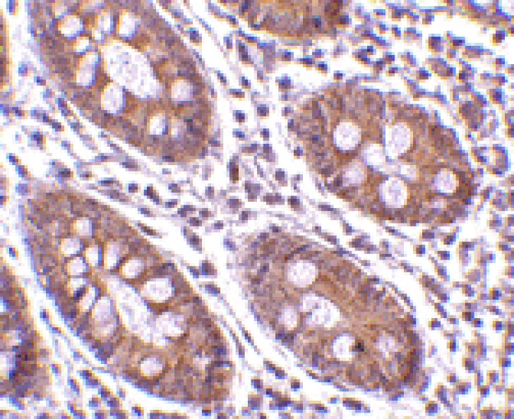Immunohistochemistry - Anti-CDKN2A Antibody (A283136) - Antibodies.com