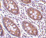 Immunohistochemistry - Anti-CDKN2A Antibody (A283136) - Antibodies.com