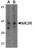 Western Blot - Anti-Neurokinin B Receptor Antibody (A283137) - Antibodies.com
