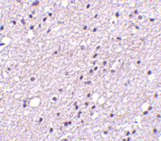 Immunohistochemistry - Anti-Neurokinin B Receptor Antibody (A283137) - Antibodies.com
