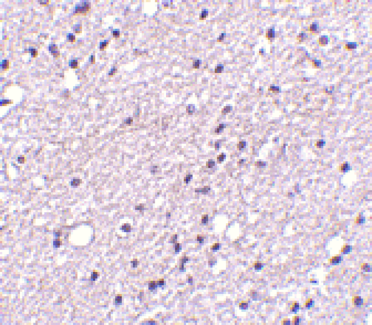 Immunohistochemistry - Anti-Neurokinin B Receptor Antibody (A283137) - Antibodies.com