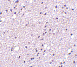 Immunohistochemistry - Anti-Neurokinin B Receptor Antibody (A283137) - Antibodies.com