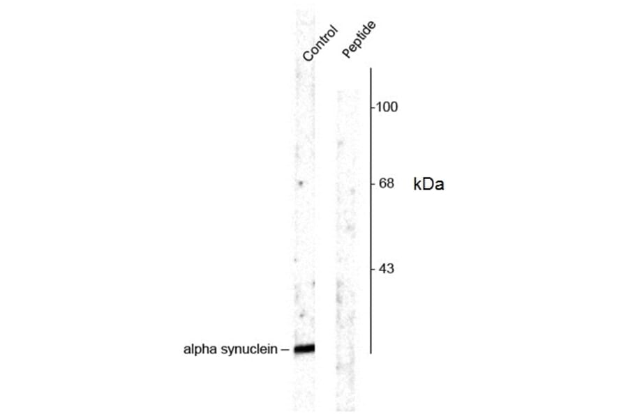 Western Blot - Anti-alpha Synuclein (phospho Ser129) Antibody (A283141) - Antibodies.com