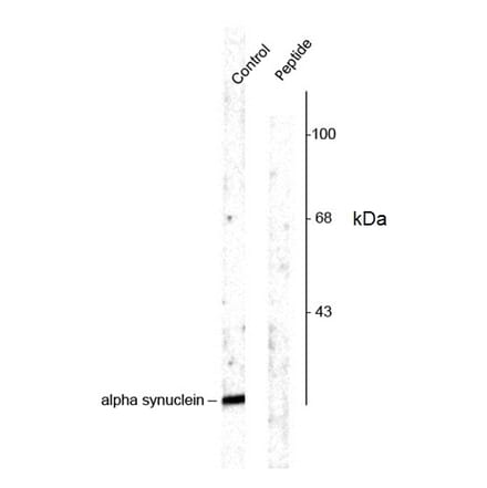 Western Blot - Anti-alpha Synuclein (phospho Ser129) Antibody (A283141) - Antibodies.com