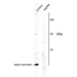 Western Blot - Anti-alpha Synuclein (phospho Ser129) Antibody (A283141) - Antibodies.com