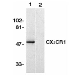 Western Blot - Anti-CX3CR1 Antibody (A283149) - Antibodies.com