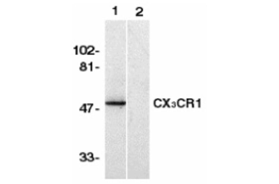 Western Blot - Anti-CX3CR1 Antibody (A283149) - Antibodies.com