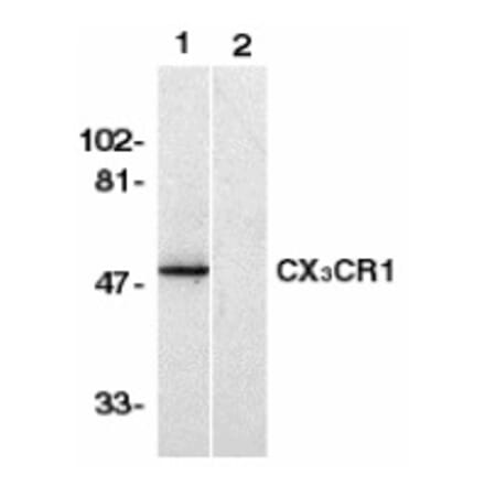 Western Blot - Anti-CX3CR1 Antibody (A283149) - Antibodies.com