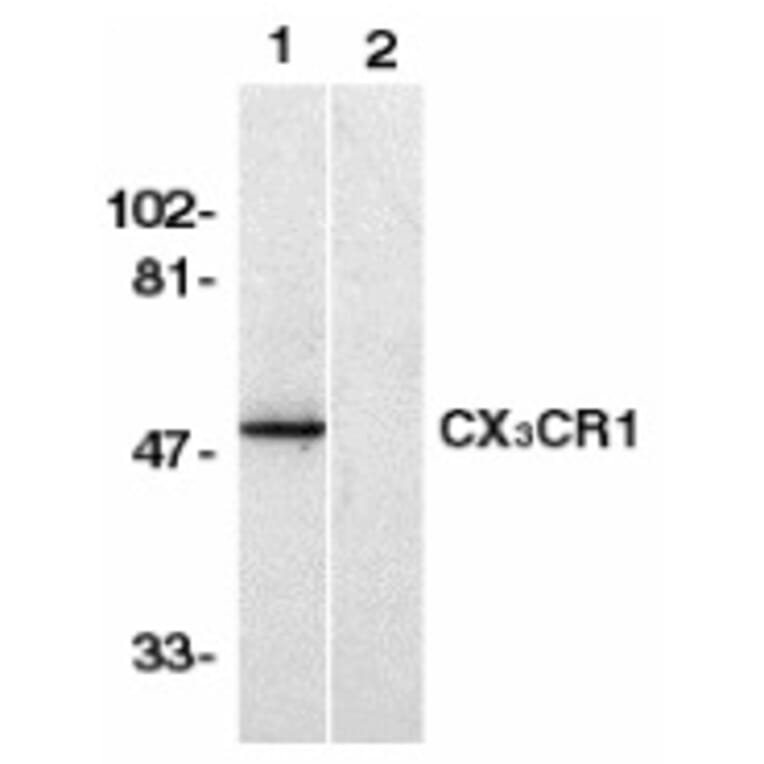 Western Blot - Anti-CX3CR1 Antibody (A283149) - Antibodies.com