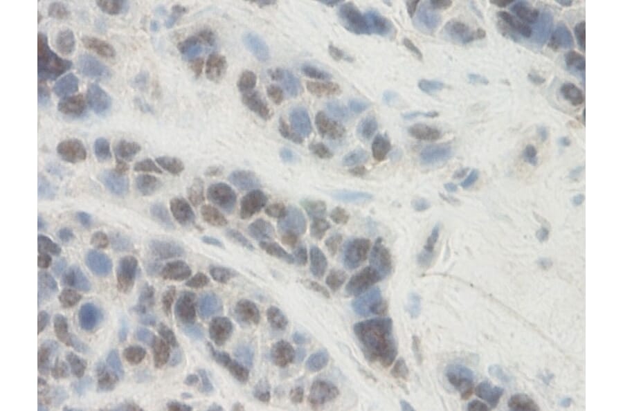 Immunohistochemistry - Anti-PAI1 Antibody - BSA and Azide free (A283160) - Antibodies.com
