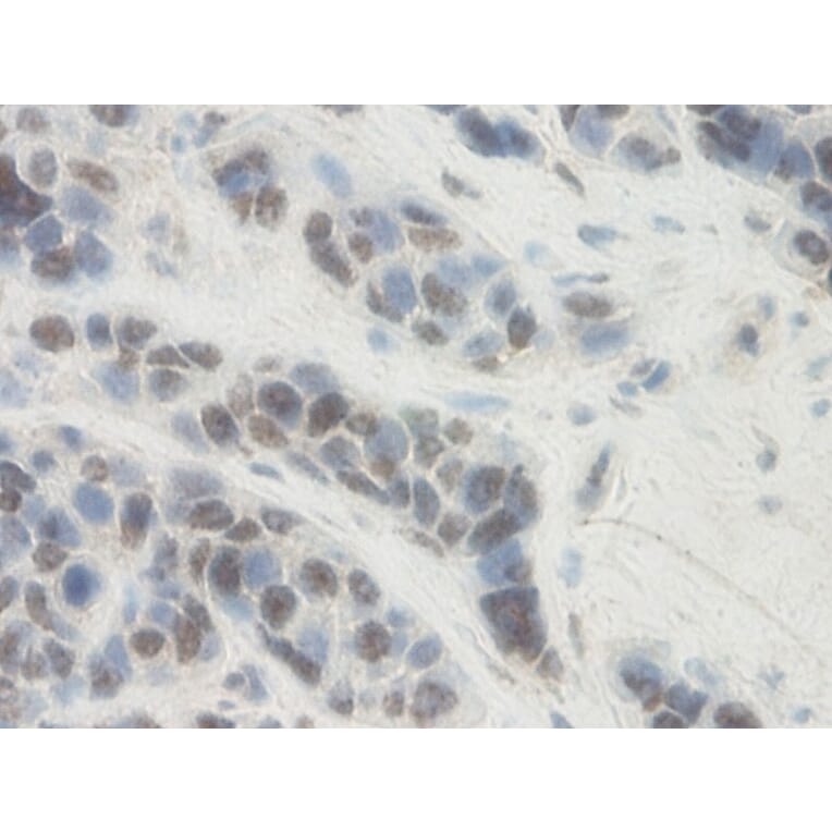 Immunohistochemistry - Anti-PAI1 Antibody - BSA and Azide free (A283160) - Antibodies.com