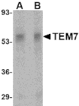 Western Blot - Anti-TEM7 Antibody (A283163) - Antibodies.com