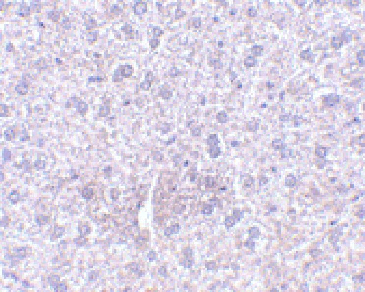 Immunohistochemistry - Anti-TEM7 Antibody (A283163) - Antibodies.com