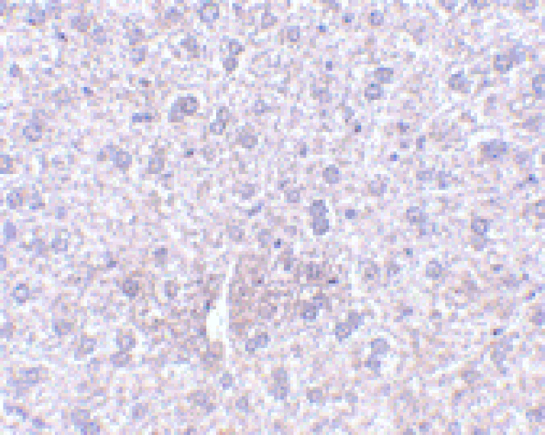Immunohistochemistry - Anti-TEM7 Antibody (A283163) - Antibodies.com