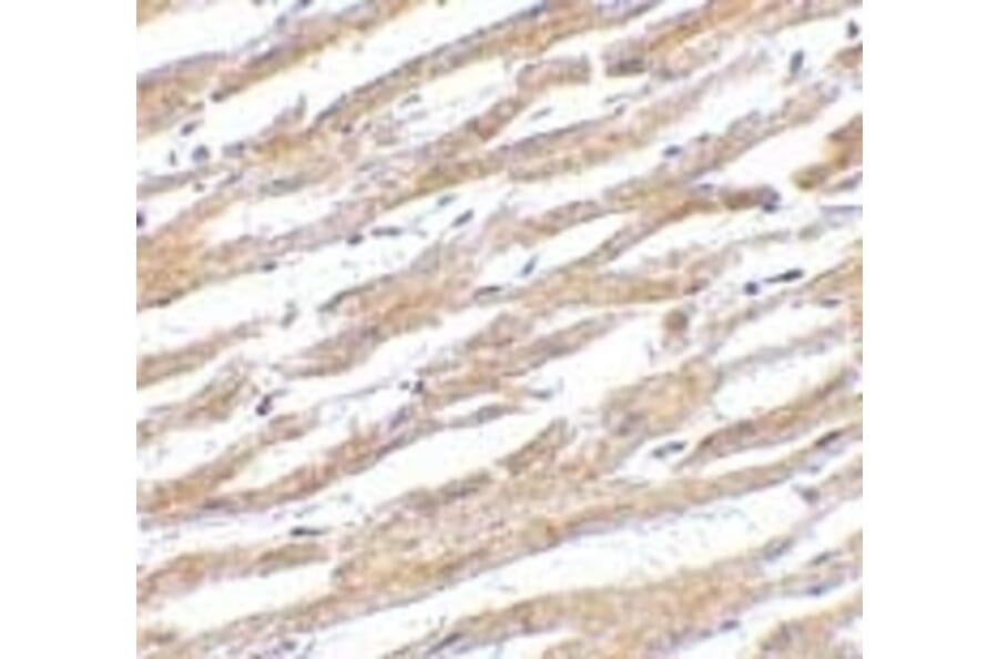 Immunohistochemistry - Anti-PD-L1 Antibody (A283184) - Antibodies.com