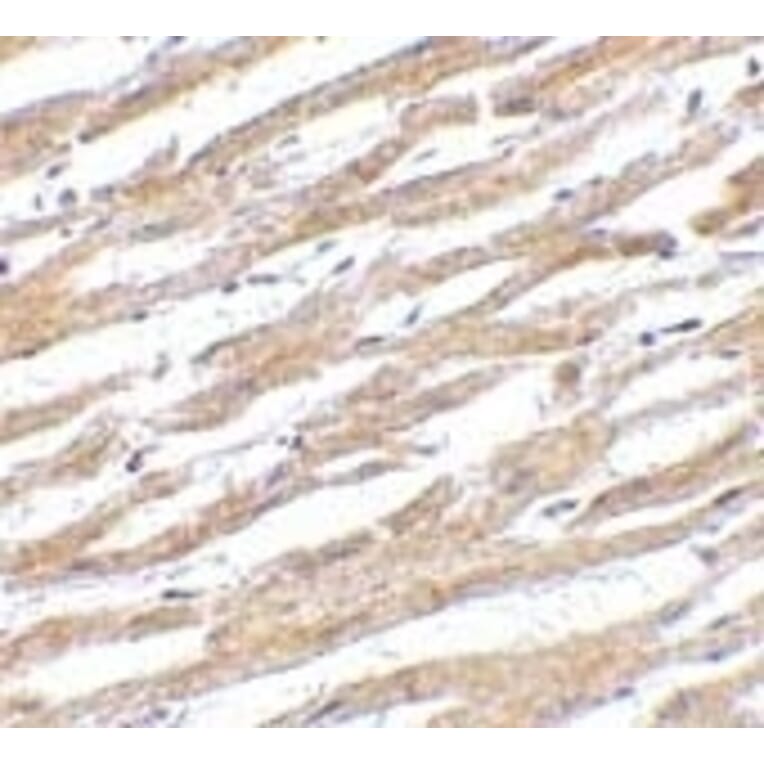 Immunohistochemistry - Anti-PD-L1 Antibody (A283184) - Antibodies.com