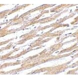 Immunohistochemistry - Anti-PD-L1 Antibody (A283184) - Antibodies.com