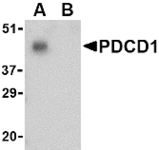 Western Blot - Anti-PD1 Antibody (A283186) - Antibodies.com