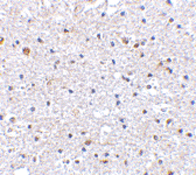 Immunohistochemistry - Anti-PD1 Antibody (A283186) - Antibodies.com