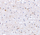 Immunohistochemistry - Anti-PD1 Antibody (A283186) - Antibodies.com