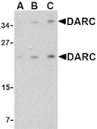 Western Blot - Anti-DARC Antibody (A283188) - Antibodies.com