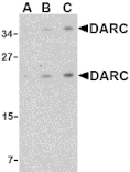 Western Blot - Anti-DARC Antibody (A283188) - Antibodies.com