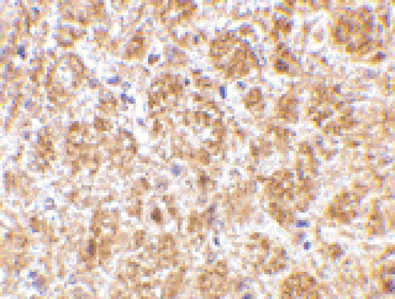 Immunohistochemistry - Anti-DARC Antibody (A283188) - Antibodies.com