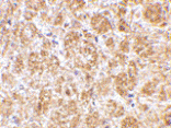 Immunohistochemistry - Anti-DARC Antibody (A283188) - Antibodies.com