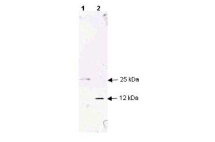 Western Blot - Anti-TGF beta 1 Antibody (A283195) - Antibodies.com