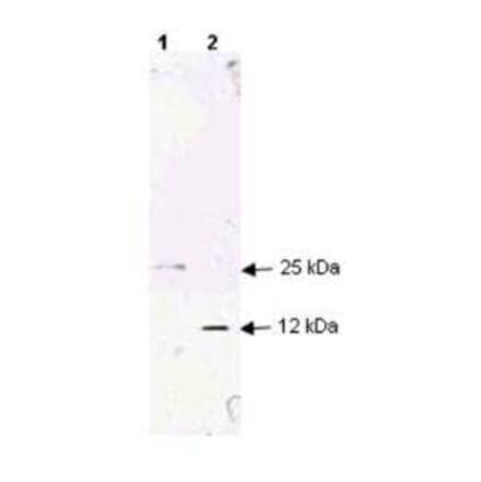 Western Blot - Anti-TGF beta 1 Antibody (A283195) - Antibodies.com