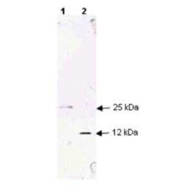 Western Blot - Anti-TGF beta 1 Antibody (A283195) - Antibodies.com